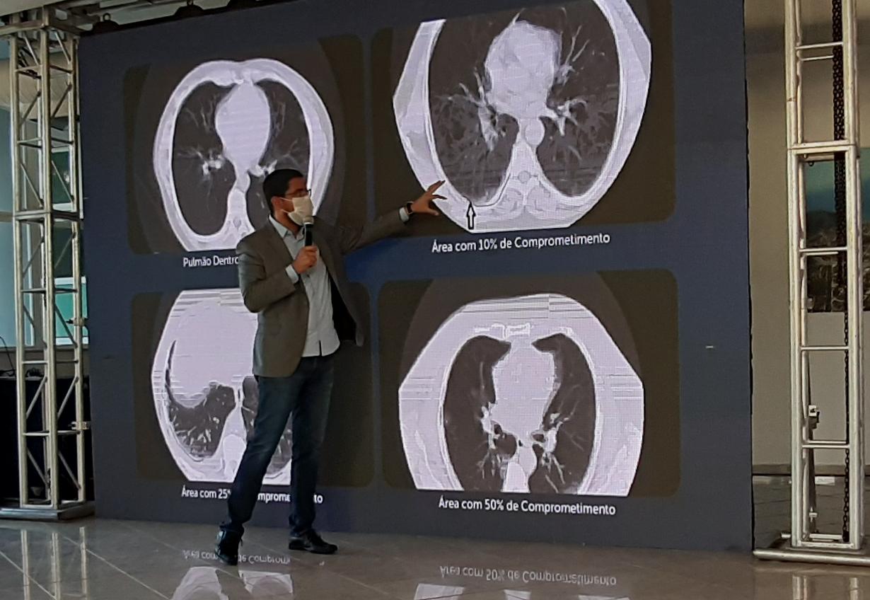 Aguilar Júnior mostra imagens de tomografia e evolução do coronavírus