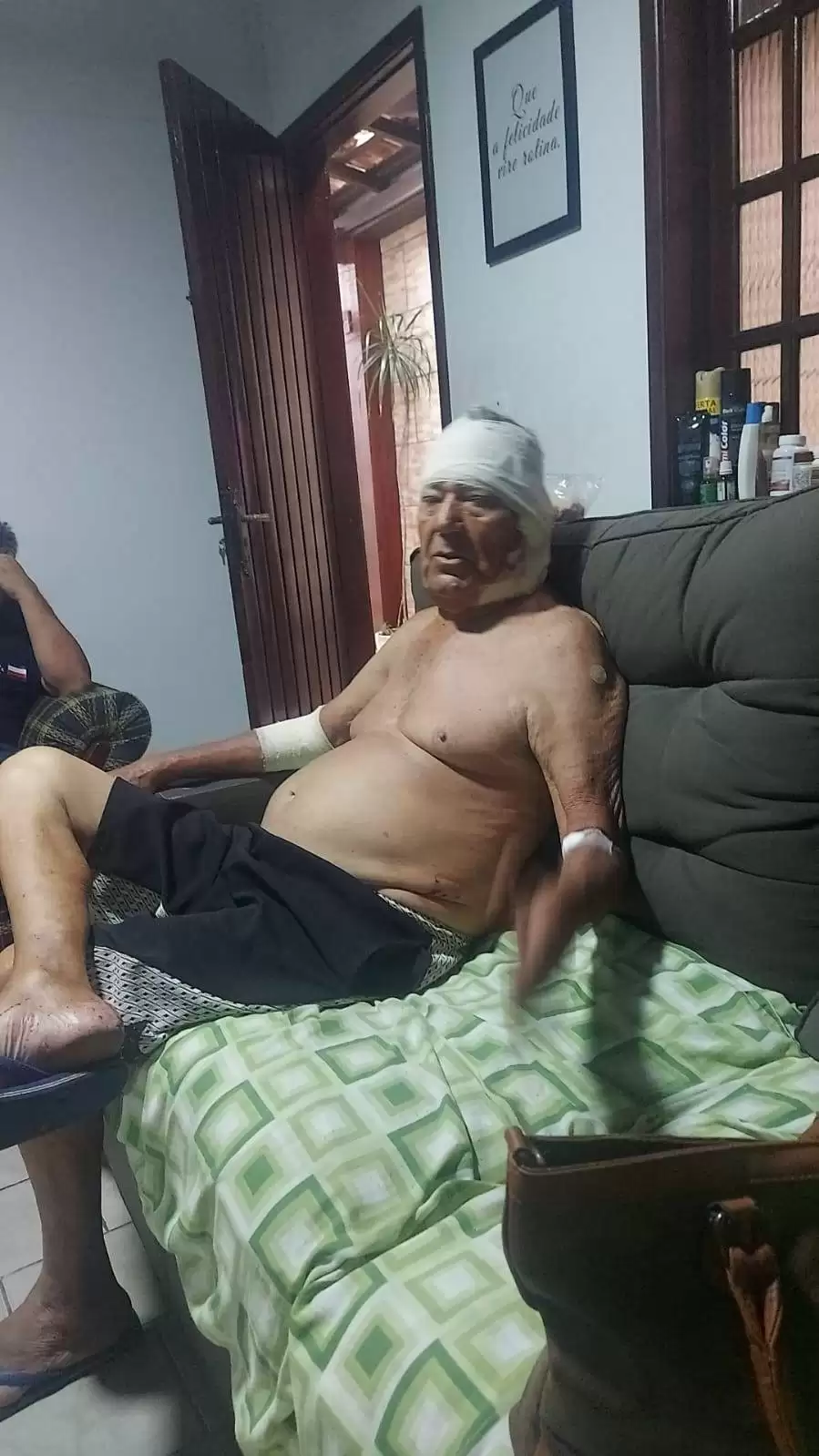 mordida pitbull caraguatatuba